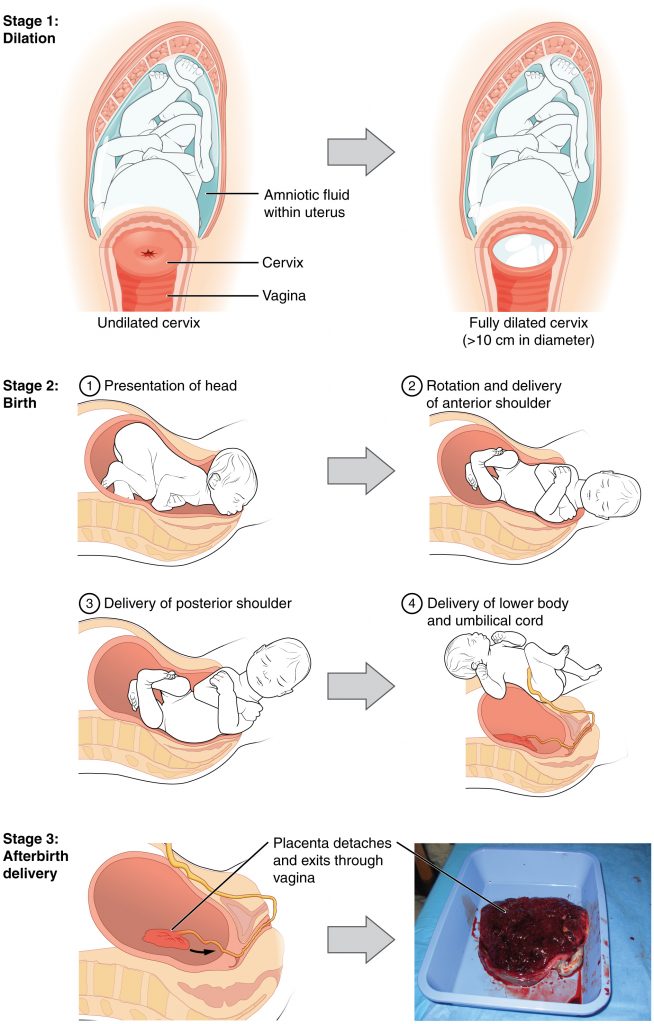 An infographic illustrating the stages of birth for vaginal delivery