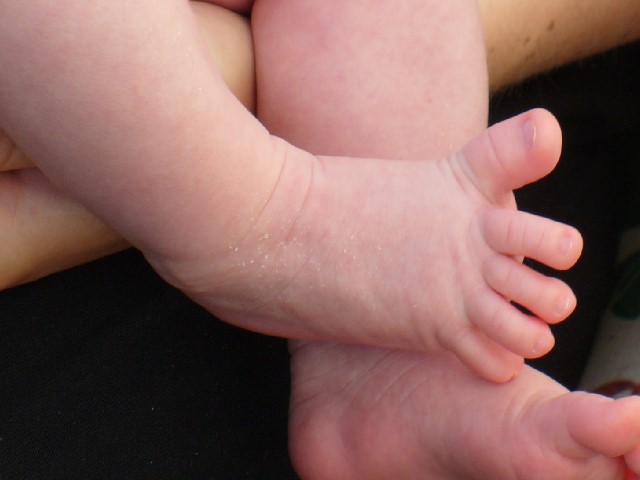 A baby curling its toes