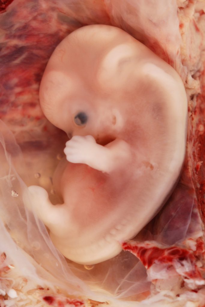 A 9-week-old embryo
