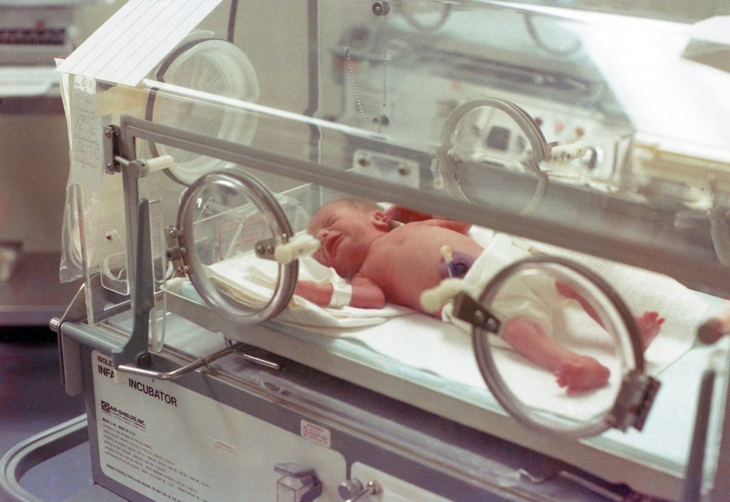 Newborn in the neonatal unit
