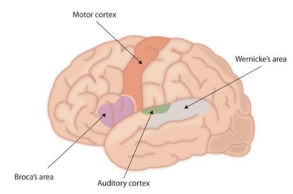 An image of a brain showing Broca’s and Wernicke’s areas, motor cortex, and auditory cortex.
