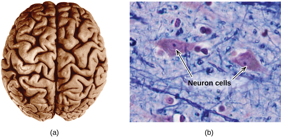 Two pictures are shown. The left picture shows the human brain. The right picture is a microscopic image that depicts two large irregularly shaped masses in a field of threadlike material interspersed with smaller, relatively round masses. The two larger masses are labeled with arrows and the phrase “Neuron cells.”