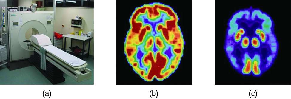 Three pictures are shown and labeled “a,” “b” and “c.” Picture a shows a machine with a round opening connected to an examination table. Picture b is a medical scan of the top of a person’s head and shows large patches of yellow and red and smaller patches of blue, green and purple highlighting. Picture c also shows a medical scan of the top of a person’s head, but this image is mostly colored in blue and purple with very small patches of red and yellow.